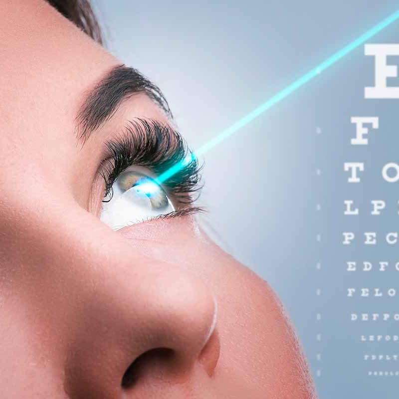 Cirugia Lasik FAQ